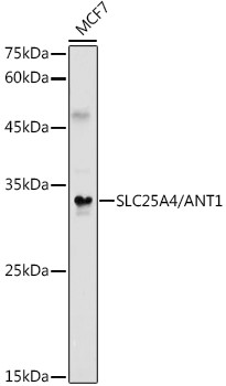 ANT Antibody in Western Blot (WB)