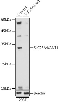 ANT Antibody in Western Blot (WB)