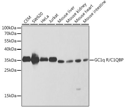 C1QBP Antibody in Western Blot (WB)