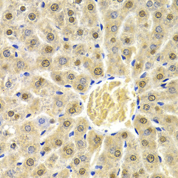 RAD9 Antibody in Immunohistochemistry (Paraffin) (IHC (P))