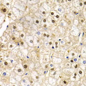 RAD9 Antibody in Immunohistochemistry (Paraffin) (IHC (P))