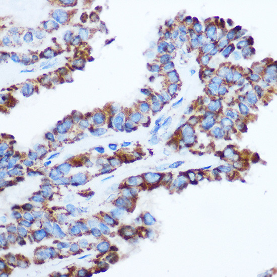 PDHA1 Antibody in Immunohistochemistry (Paraffin) (IHC (P))