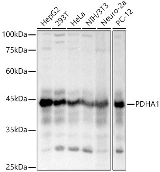 PDHA1 Antibody in Western Blot (WB)