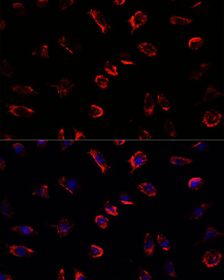 IL-11 Antibody in Immunocytochemistry (ICC/IF)