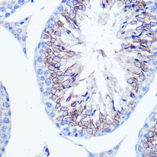 Fascin Antibody in Immunohistochemistry (Paraffin) (IHC (P))