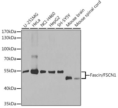 Fascin Antibody in Western Blot (WB)