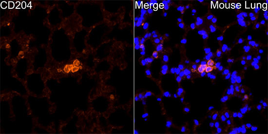 CD204 Antibody in Immunocytochemistry (ICC/IF)