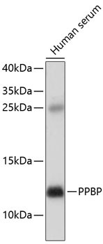 PPBP Antibody in Western Blot (WB)