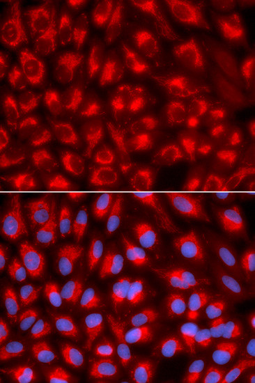 TFAM Antibody in Immunocytochemistry (ICC/IF)