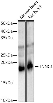 Cardiac Troponin C Antibody in Western Blot (WB)