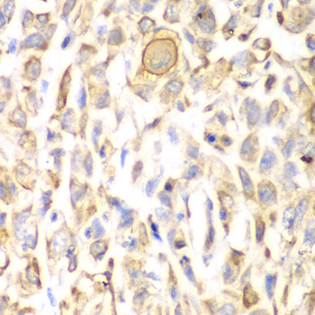 CD151 Antibody in Immunohistochemistry (Paraffin) (IHC (P))