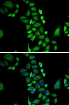 GLO1 Antibody in Immunocytochemistry (ICC/IF)