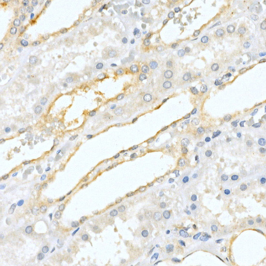 Prostate Specific Acid Phosphatase Antibody in Immunohistochemistry (Paraffin) (IHC (P))