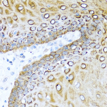 S100A7 Antibody in Immunohistochemistry (Paraffin) (IHC (P))