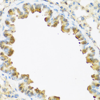 S100A7 Antibody in Immunohistochemistry (Paraffin) (IHC (P))