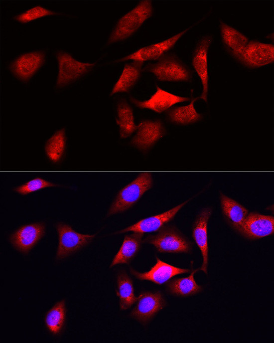 ODC1 Antibody in Immunocytochemistry (ICC/IF)