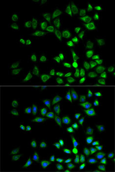 PSMD10 Antibody in Immunocytochemistry (ICC/IF)