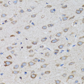 PSMD10 Antibody in Immunohistochemistry (Paraffin) (IHC (P))