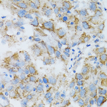 PSMD10 Antibody in Immunohistochemistry (Paraffin) (IHC (P))