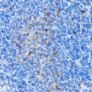 PSMD10 Antibody in Immunohistochemistry (Paraffin) (IHC (P))