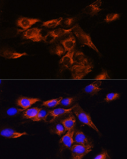 ADORA2B Antibody in Immunocytochemistry (ICC/IF)