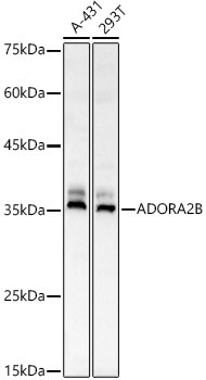 ADORA2B Antibody in Western Blot (WB)