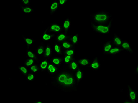 MCM6 Antibody in Immunocytochemistry (ICC/IF)