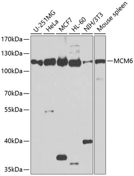 MCM6 Antibody in Western Blot (WB)