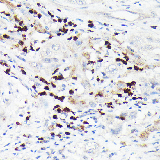 MMP8 Antibody in Immunohistochemistry (Paraffin) (IHC (P))