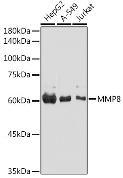 MMP8 Antibody in Western Blot (WB)