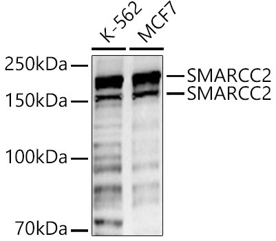 SMARCC2 Antibody in Western Blot (WB)