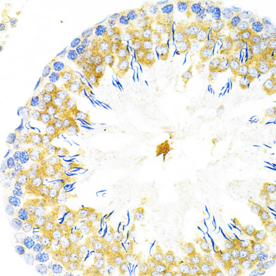 Tapasin Antibody in Immunohistochemistry (Paraffin) (IHC (P))