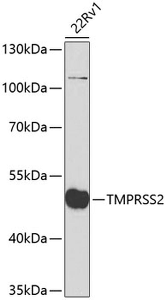 TMPRSS2 Antibody in Western Blot (WB)