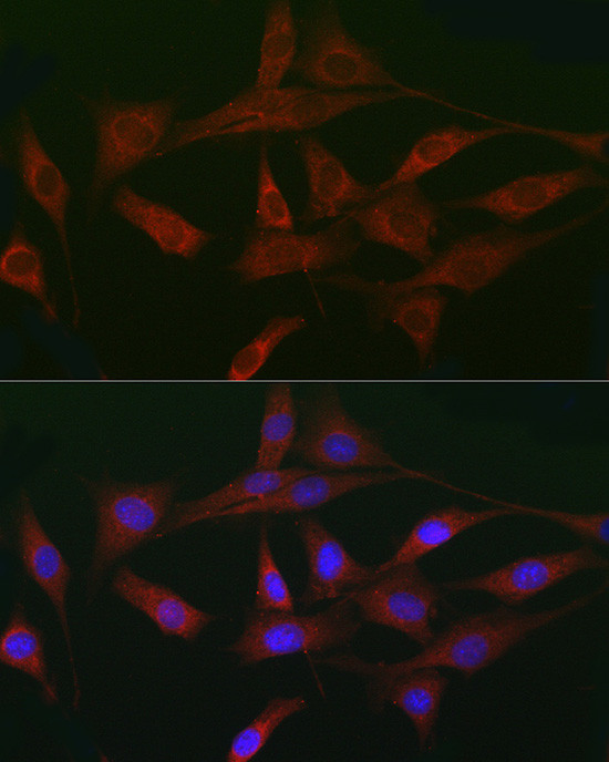 ACVR2A Antibody in Immunocytochemistry (ICC/IF)