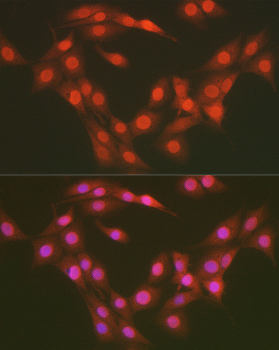 OGT Antibody in Immunocytochemistry (ICC/IF)