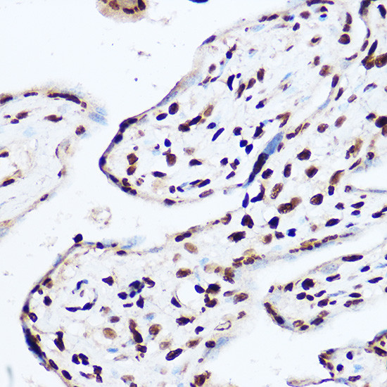 OGT Antibody in Immunohistochemistry (Paraffin) (IHC (P))