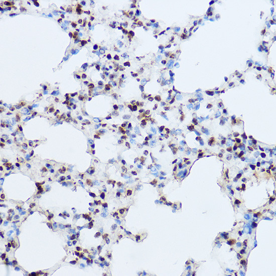 OGT Antibody in Immunohistochemistry (Paraffin) (IHC (P))