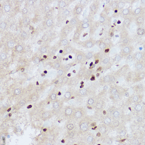 OGT Antibody in Immunohistochemistry (Paraffin) (IHC (P))