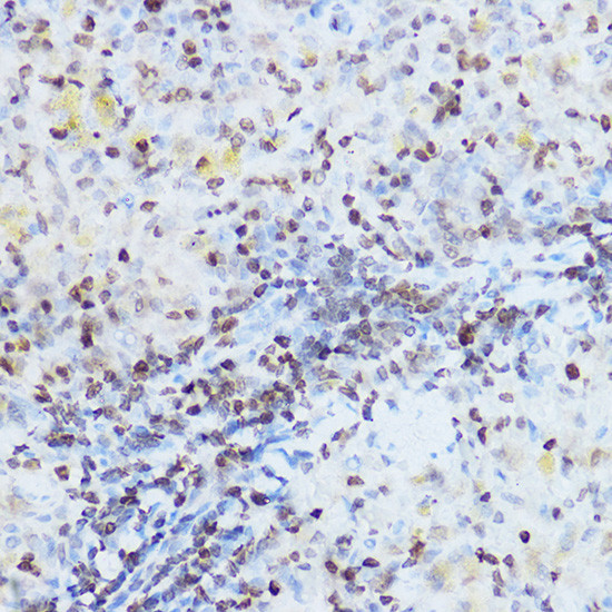 OGT Antibody in Immunohistochemistry (Paraffin) (IHC (P))