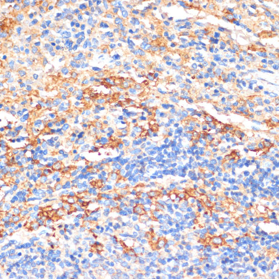 Serum Amyloid P Antibody in Immunohistochemistry (Paraffin) (IHC (P))