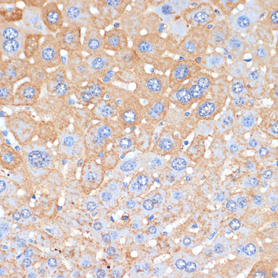 Serum Amyloid P Antibody in Immunohistochemistry (Paraffin) (IHC (P))