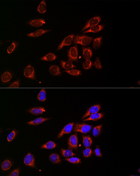 CDA Antibody in Immunocytochemistry (ICC/IF)