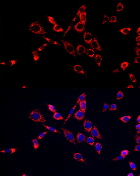 CDA Antibody in Immunocytochemistry (ICC/IF)