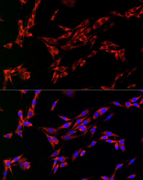 CDA Antibody in Immunocytochemistry (ICC/IF)