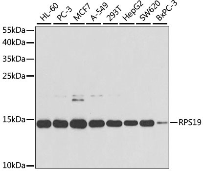 RPS19 Antibody in Western Blot (WB)