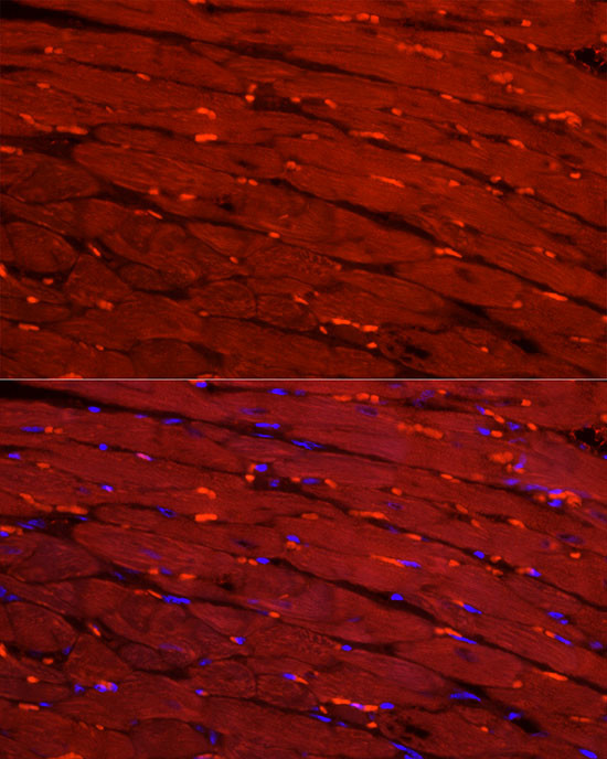 Creatine Kinase MB Antibody in Immunocytochemistry (ICC/IF)