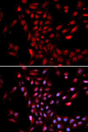 KPNA4 Antibody in Immunocytochemistry (ICC/IF)