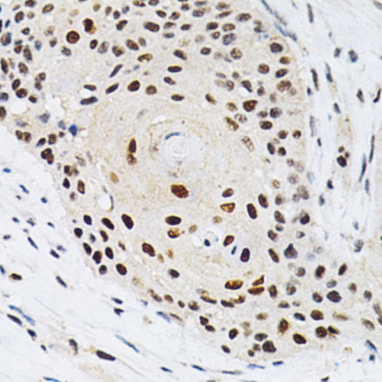 KPNA4 Antibody in Immunohistochemistry (Paraffin) (IHC (P))