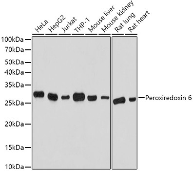 PRDX6 Antibody in Western Blot (WB)