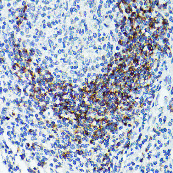 CD79b Antibody in Immunohistochemistry (Paraffin) (IHC (P))